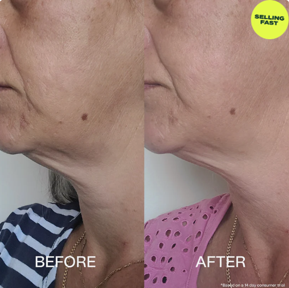The Sculpt & Lift Neck Serum