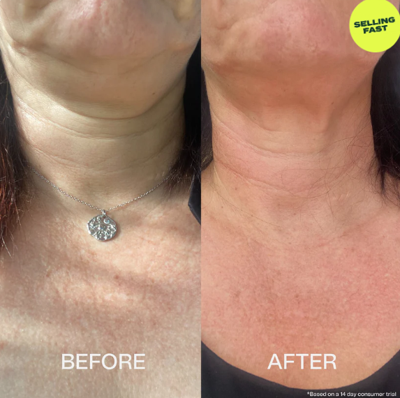 The Sculpt & Lift Neck Serum